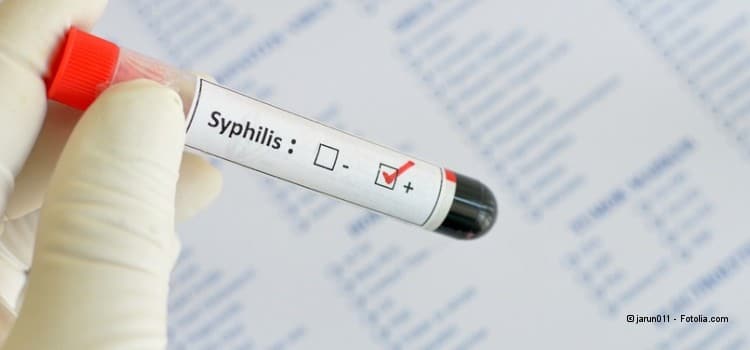 „Mit Syphilis kann man sich auch beim Küssen oder beim Oralverkehr infizieren.“ – Im Gespräch mit einem Allgemeinmediziner